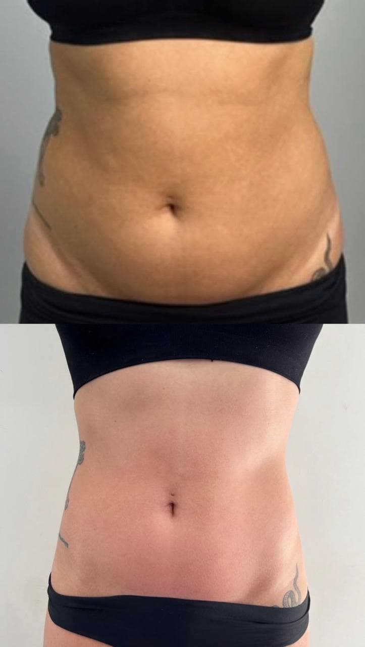 Registro de transformação corporal feminina com treino e rotina
